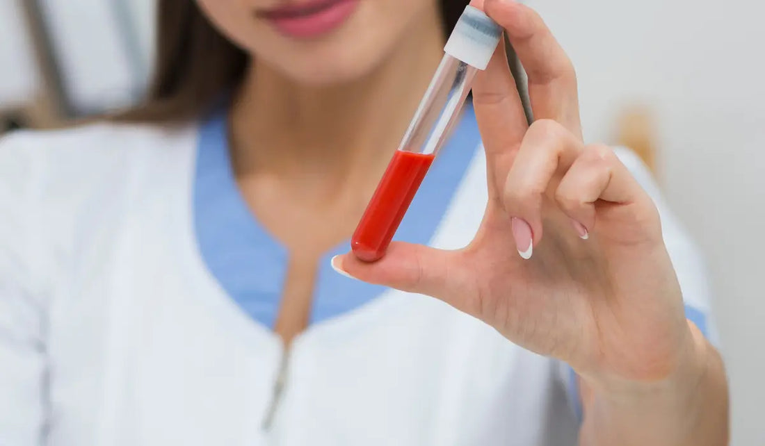 mpv-blood-test